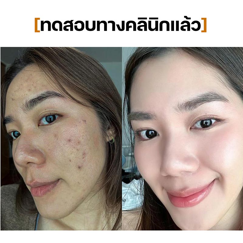 Toner Pads Gel (Purple) SEYOUL - Seyoul Thailand
