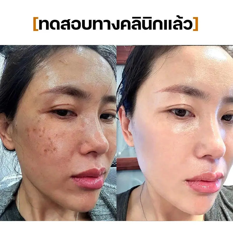 Serum 21days SEYOUL - Seyoul Thailand
