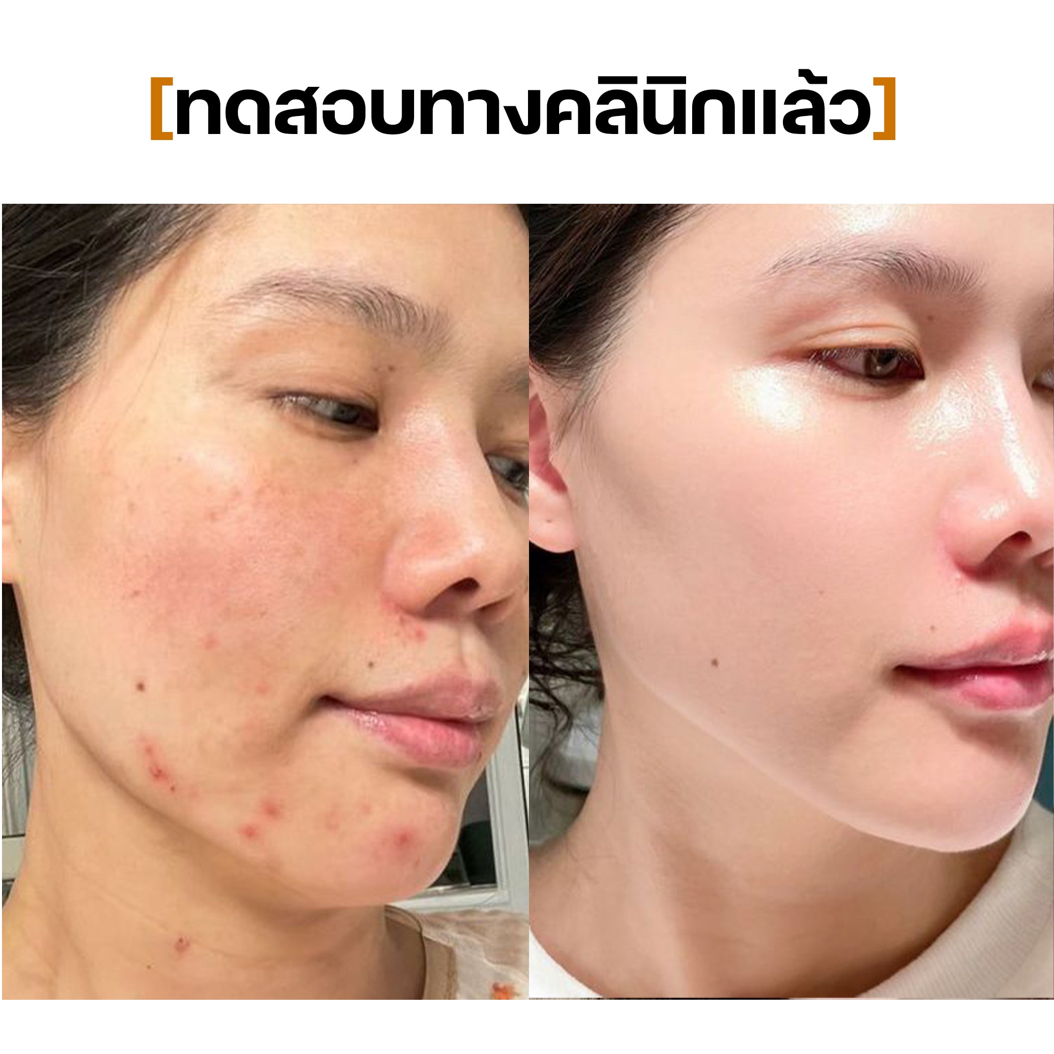 Toner Pads SEYOUL