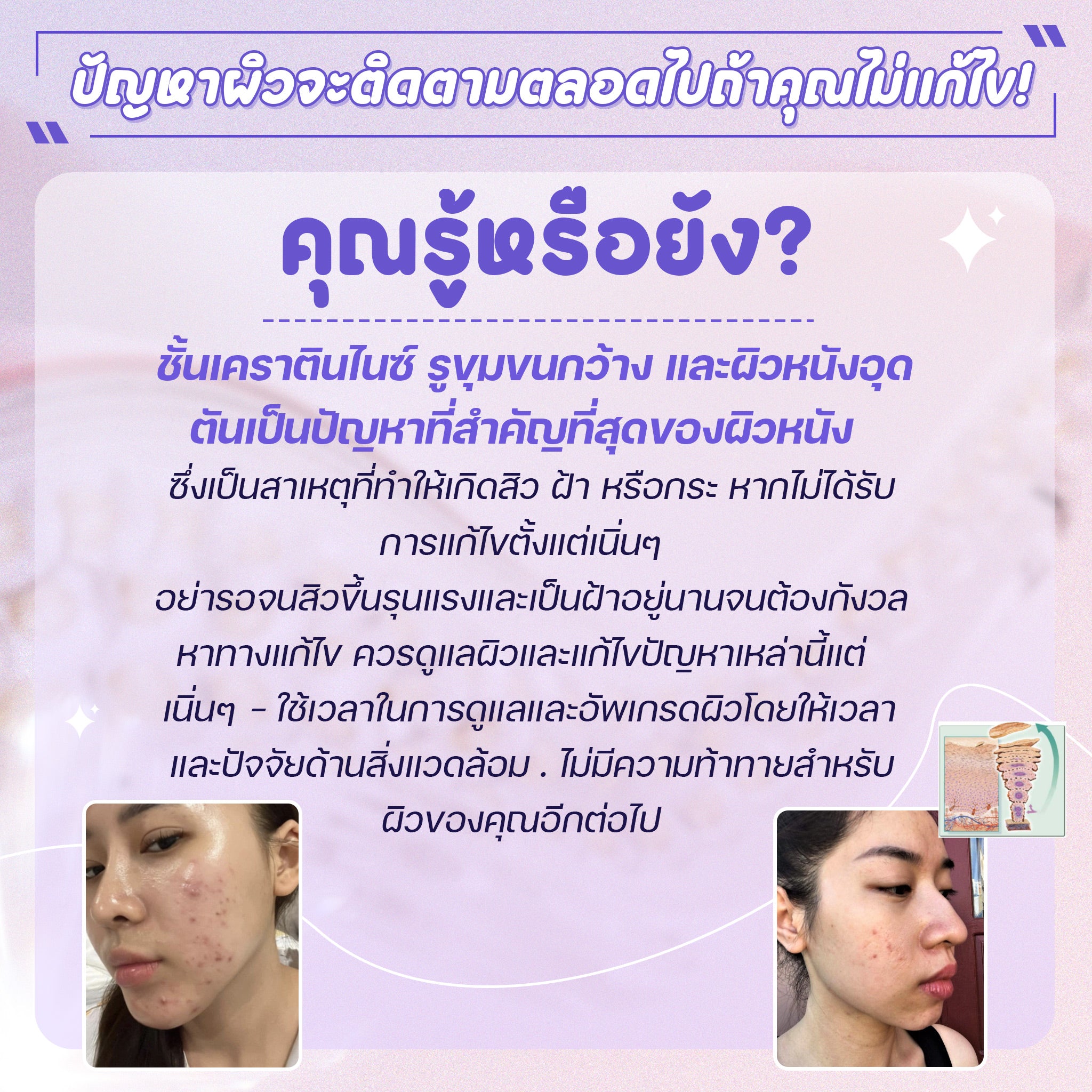 Toner Pads SEYOUL