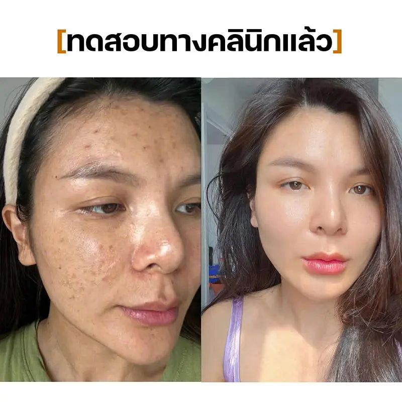 Serum 21days SEYOUL - Seyoul Thailand