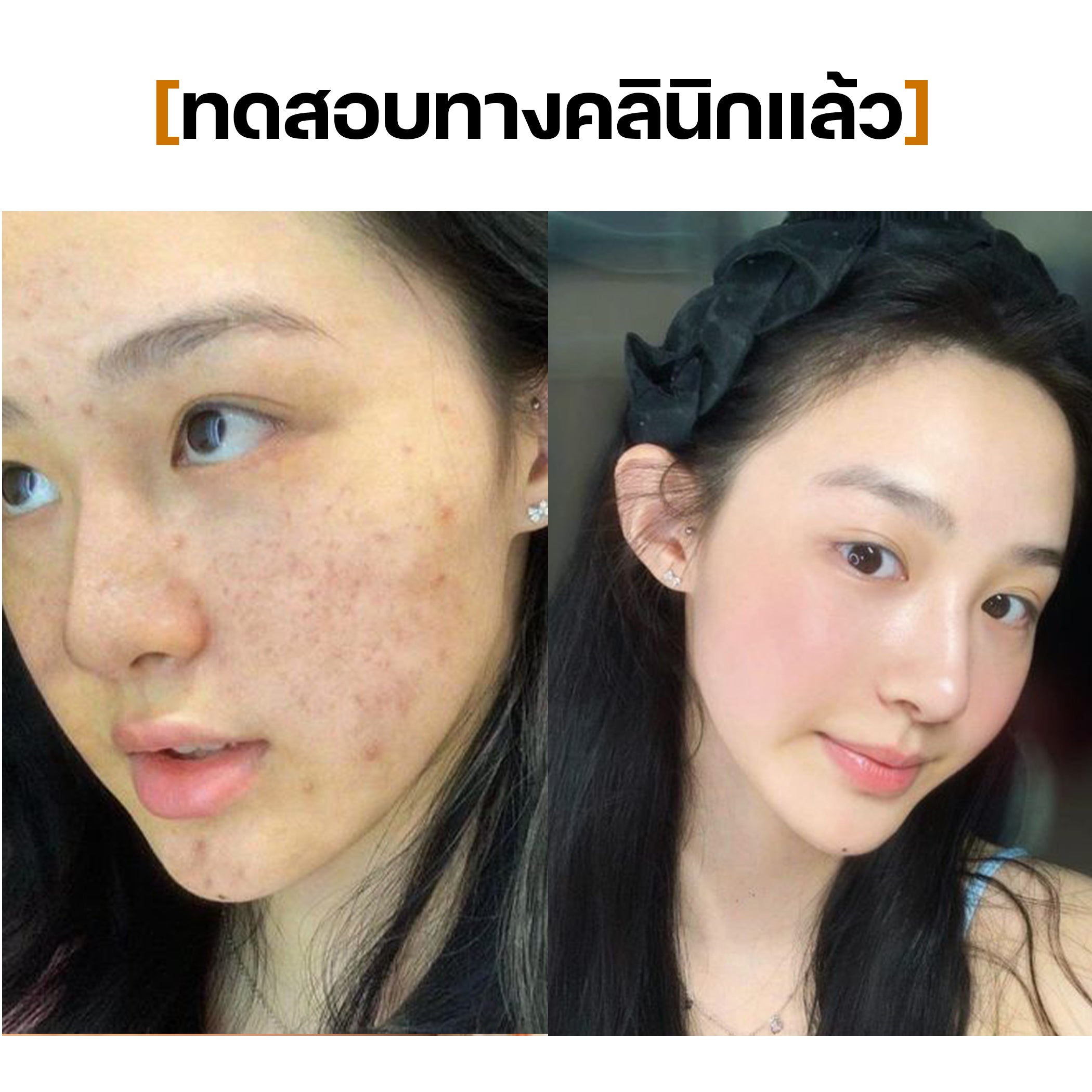Toner Pads SEYOUL