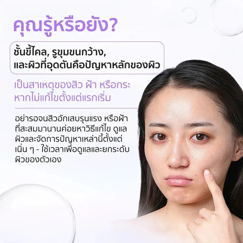 Woman with bare face pointing to acne on her cheek, skincare and acne treatment concept, Thai text overlay.