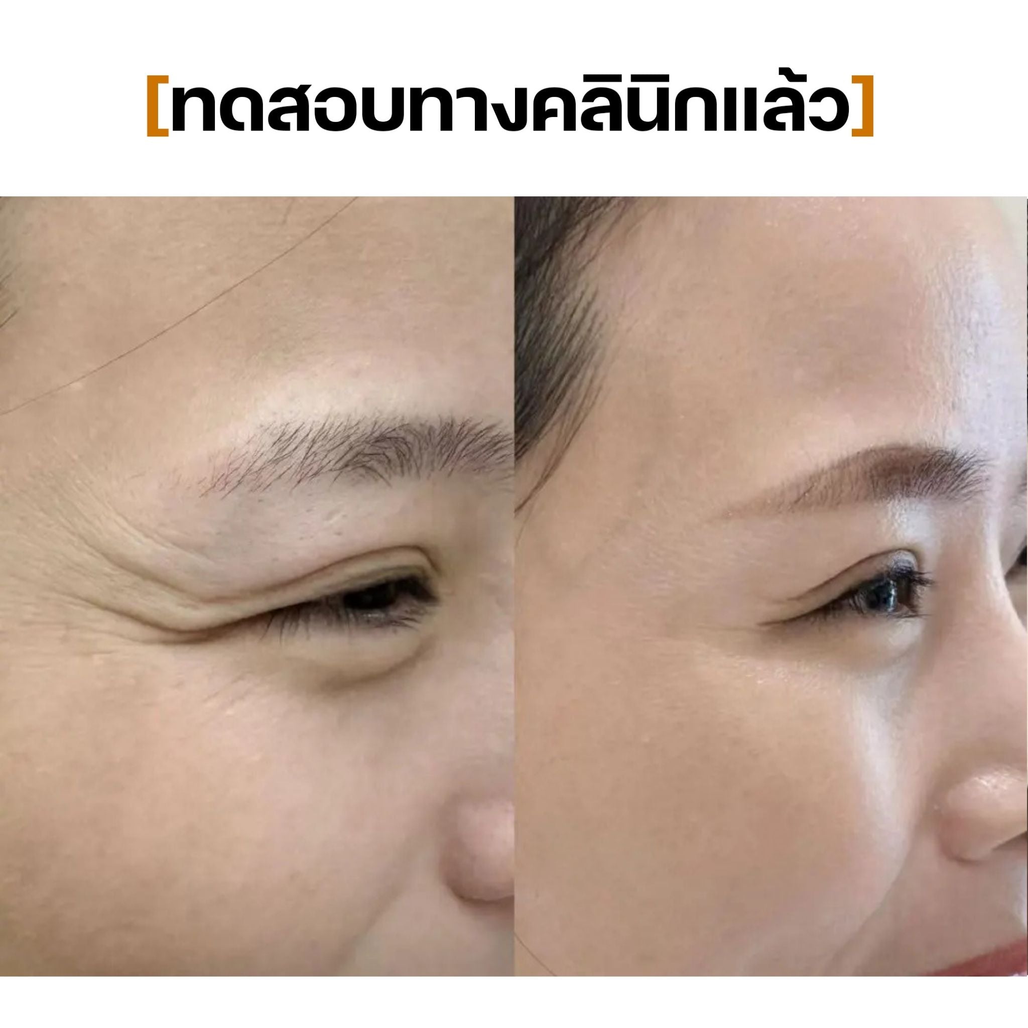 Eye Cream SEYOUL