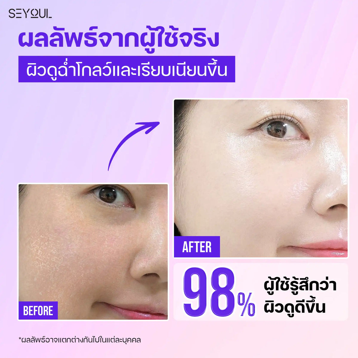 Before and after close-up of woman's cheek showing improved skin texture and radiance from skincare product