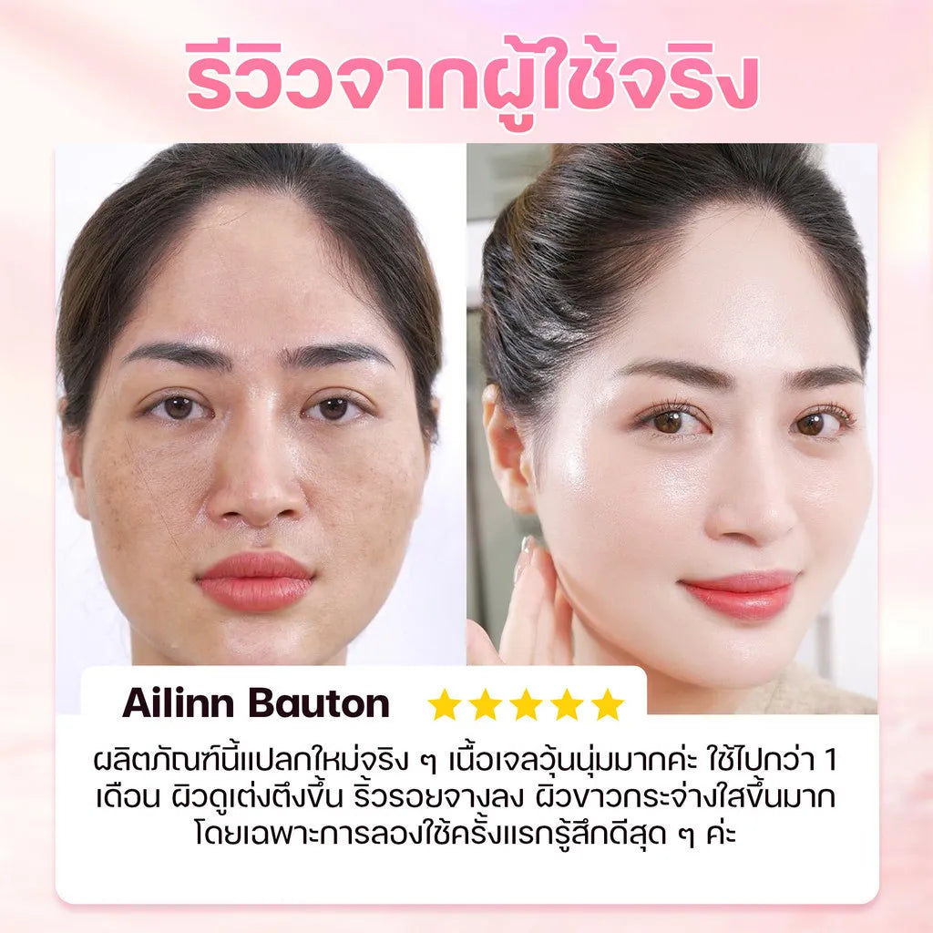 Before and after skincare result on woman's face showing improved, brighter, smoother skin