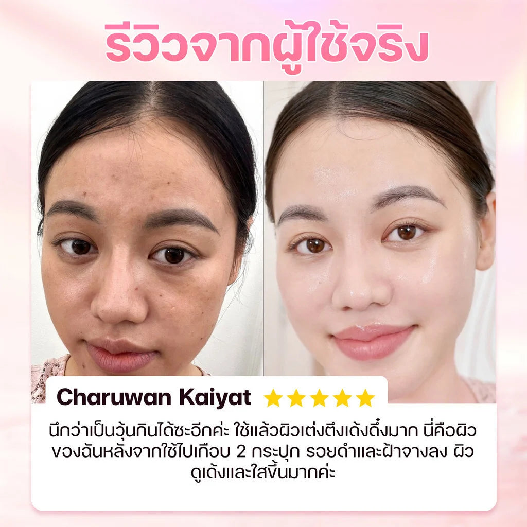 Before and after skincare result on woman's face showing reduced dark spots and brighter skin