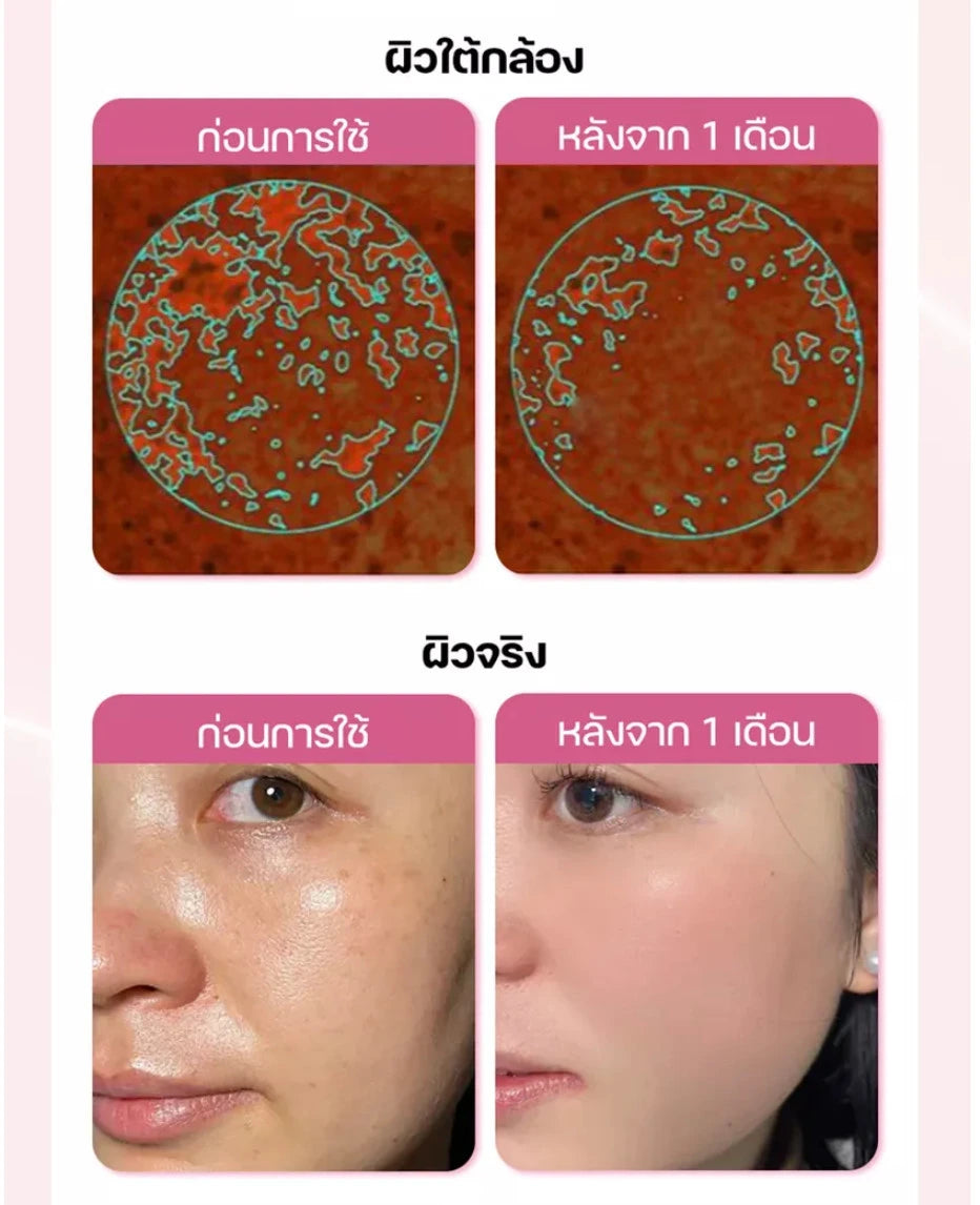 Before and after skin care results showing improved skin texture and clarity in one month
