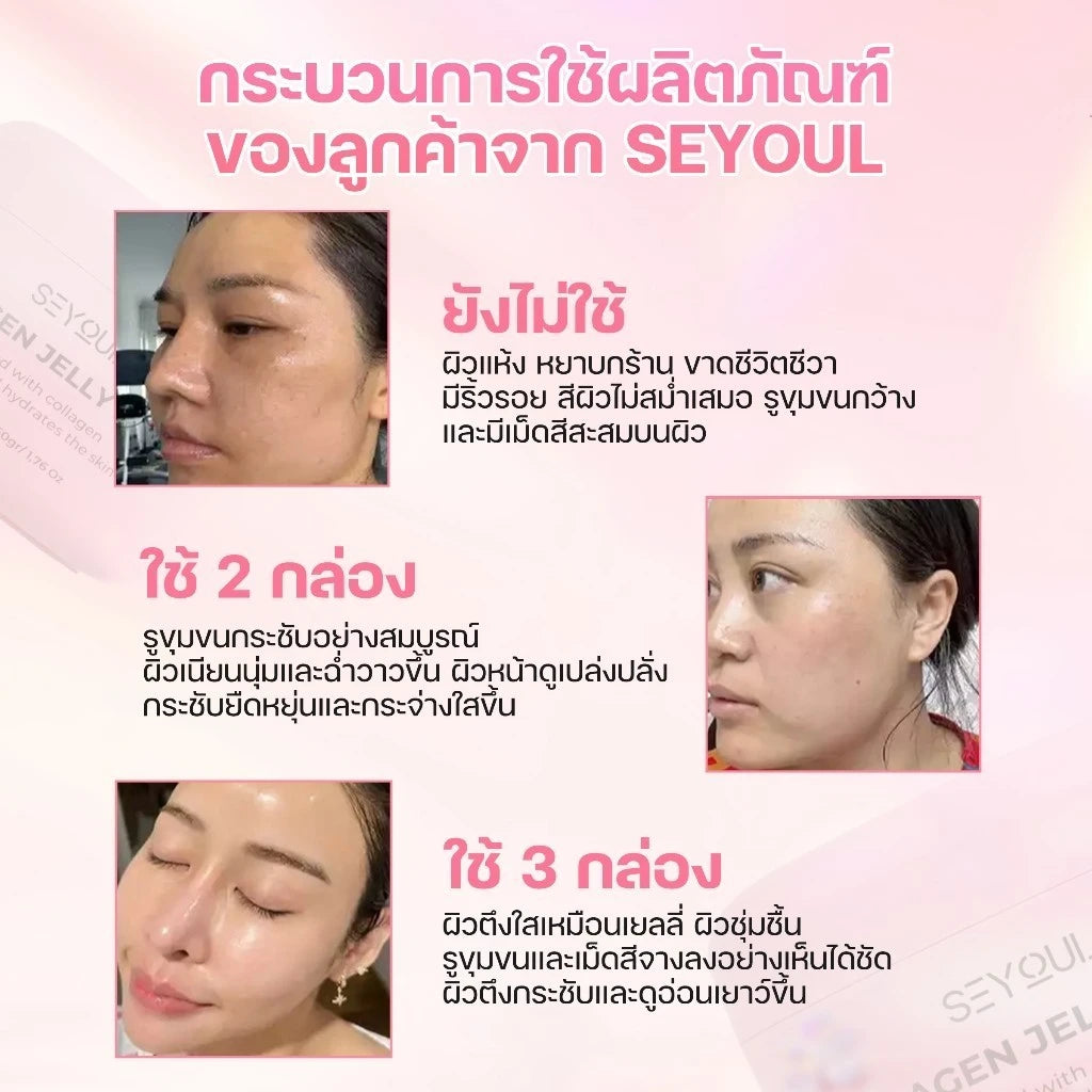 Before and after skincare results on three women, showing improved facial skin texture and radiance