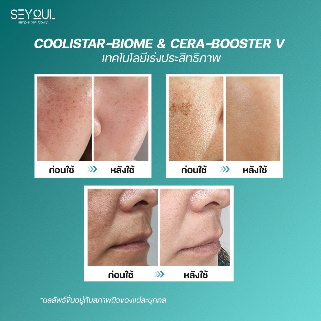 Advanced Youth Serum Seyoul