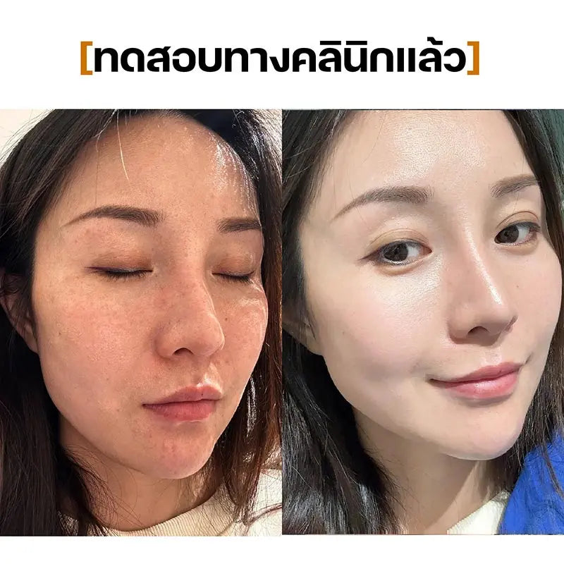 Serum 21days SEYOUL - Seyoul Thailand