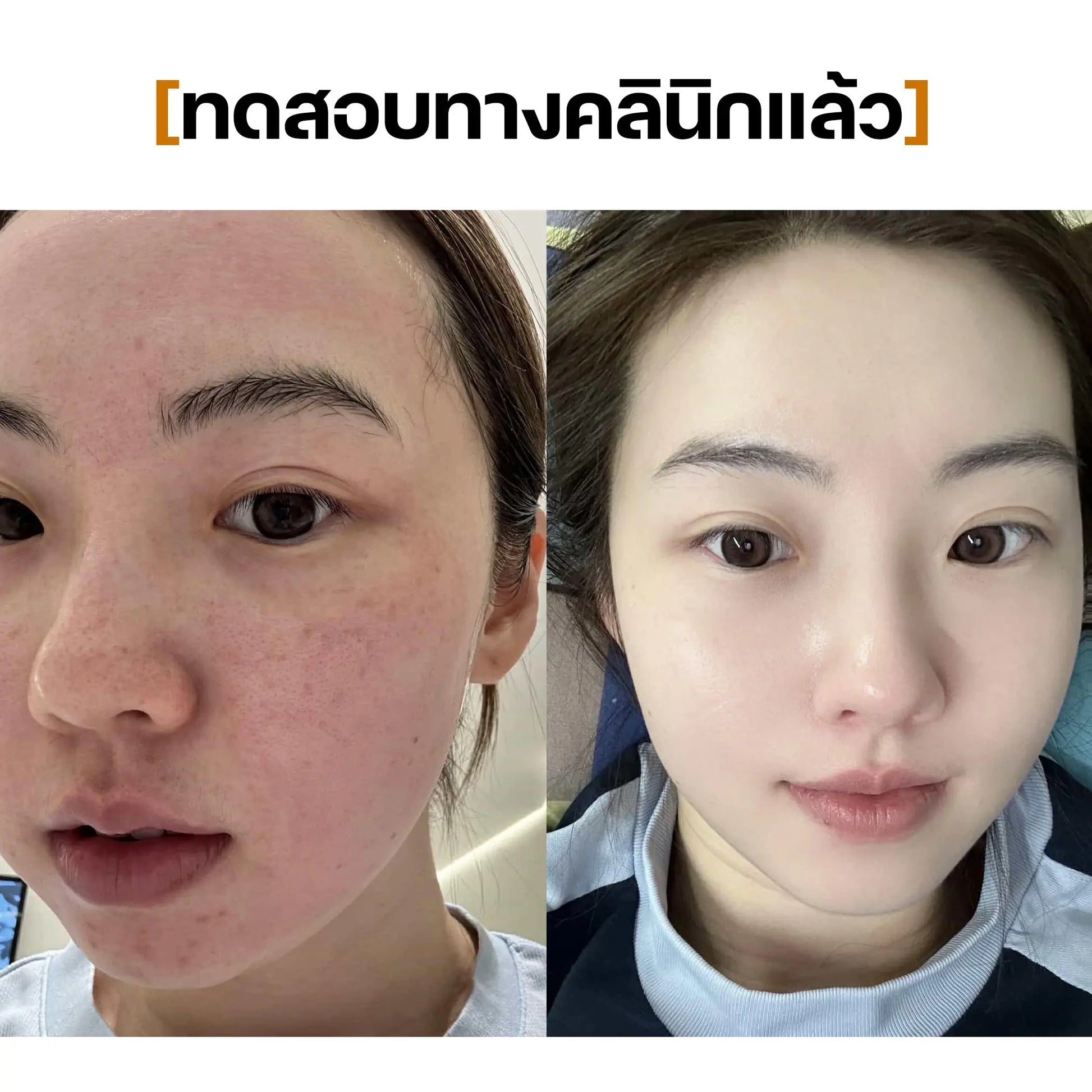 Cleansing Oil SEYOUL - Seyoul Thailand